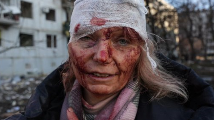 Kdo je Ukrajinka na grozljivih fotografijah, ki so preplavile splet?
