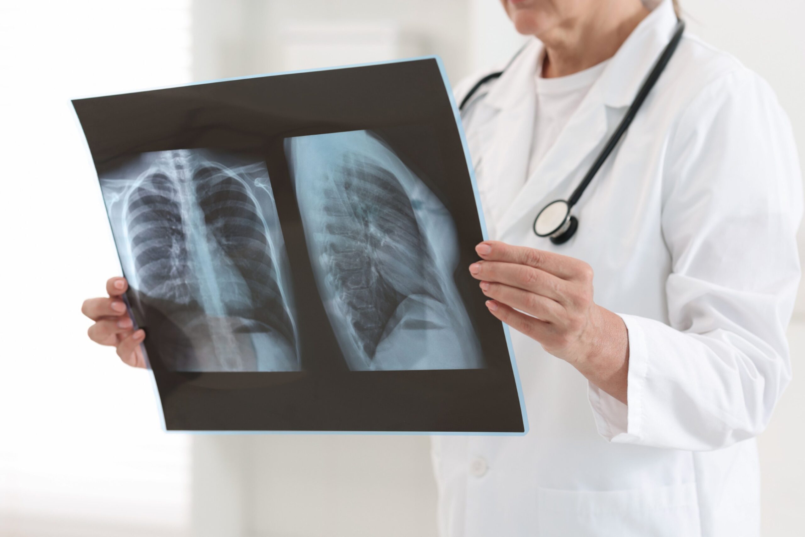 Kaj najbolj poganja epidemijo raka po svetu? Resnica je boleča
