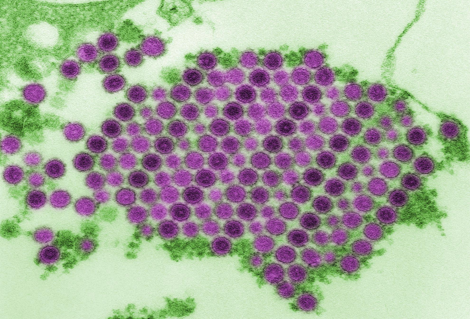 Nova globalna grožnja: Pozabljen, a nevaren virus se bliskovito hitro širi