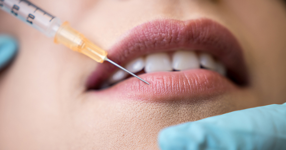 Da bi si povečala ustnice, si je 14-letnica kar sama vbrizgala olje