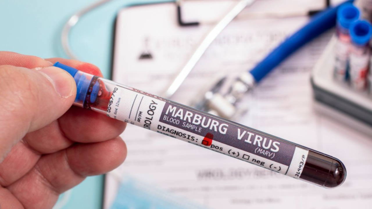 Virus marburg: Priznanega cepiva še vedno ni, zdaj začenjajo s poskusnim zdravljenem