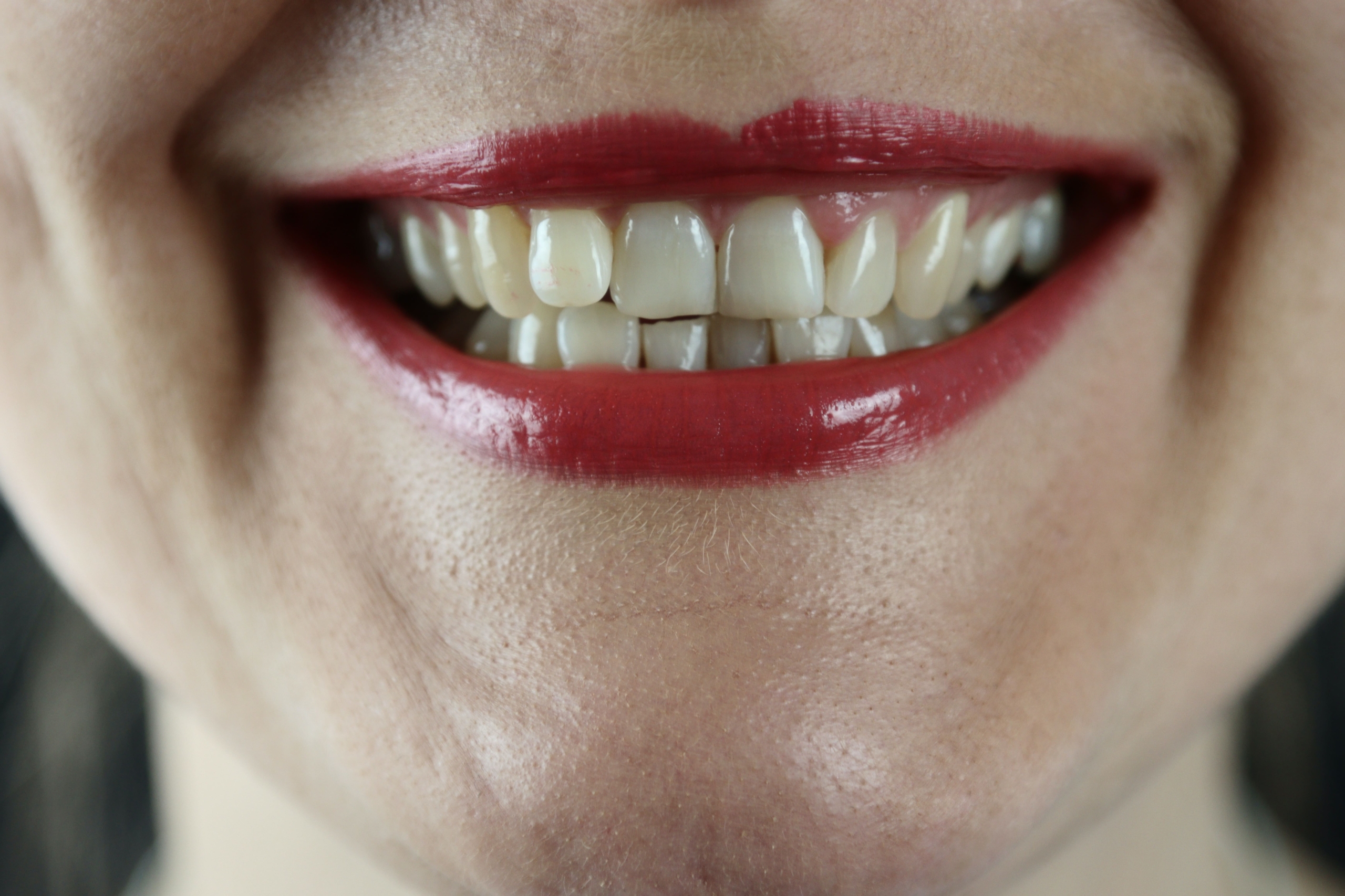 Kaj razkriva barva zob o našem zdravju?