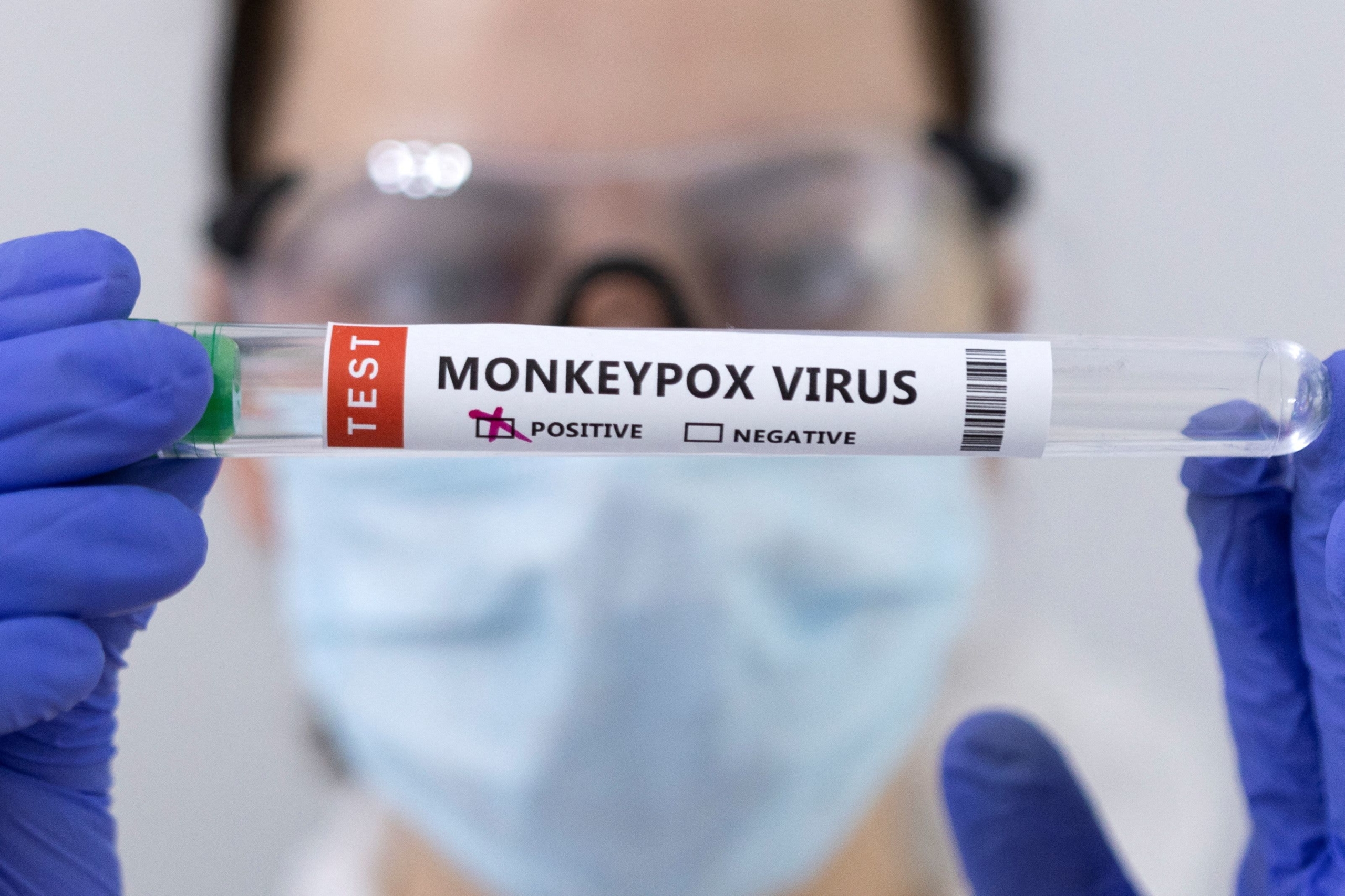 Evropska država naročila 1,5 milijona odmerkov cepiva proti opičjim kozam