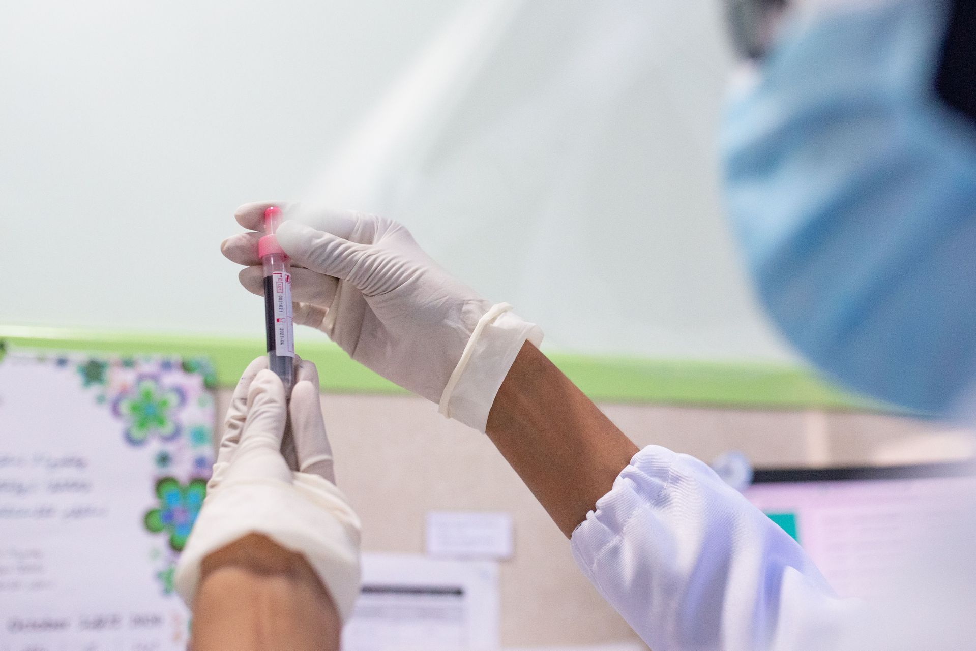 Skrivnosten virus, ki se naj ne bi prenašal na ljudi, v Evropi terjal človeško smrtno žrtev